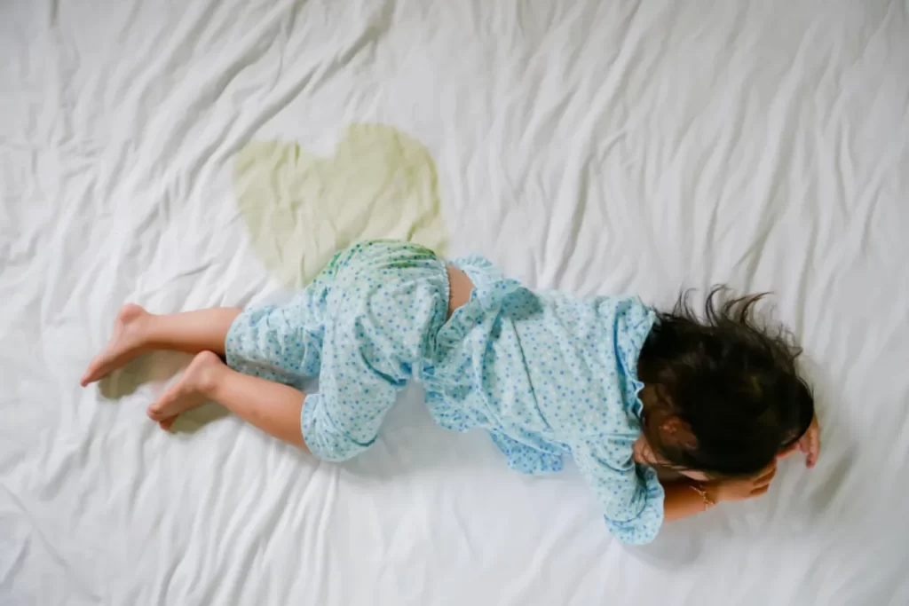 Uma criança pequena está deitada de bruços em uma cama, com um pijama azul de bolinhas, ao lado de uma mancha de urina em formato de coração no lençol branco. A imagem representa o problema da enurese noturna na infância.